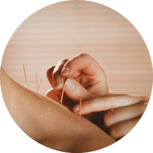 acupuncture-meridiens-outils-medecine-chinoise