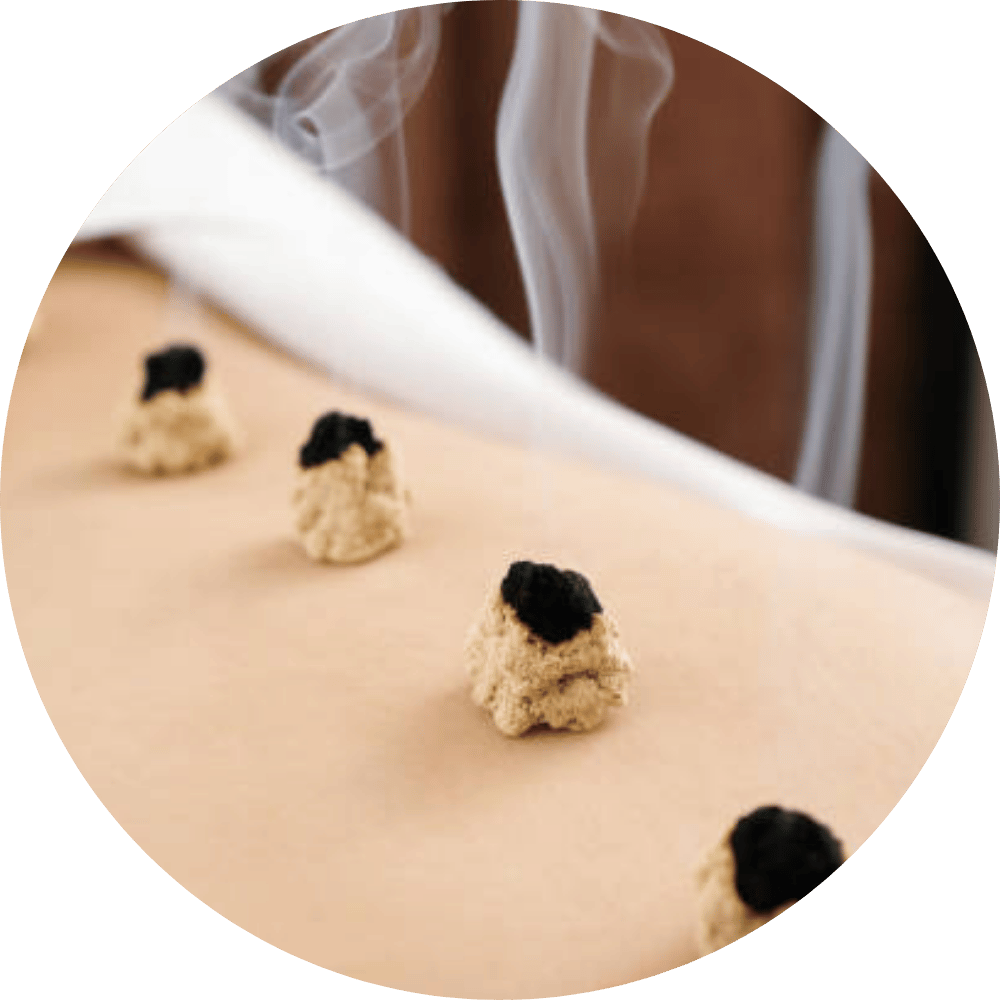 moxibustion-armoise-outils-cabinet-sainte-helene