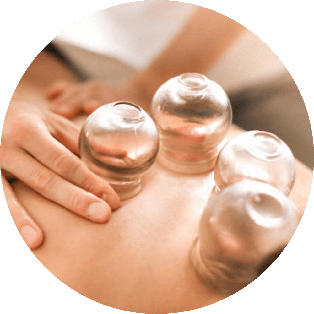 ventouses-massages-cabinet-medecine-chinoise